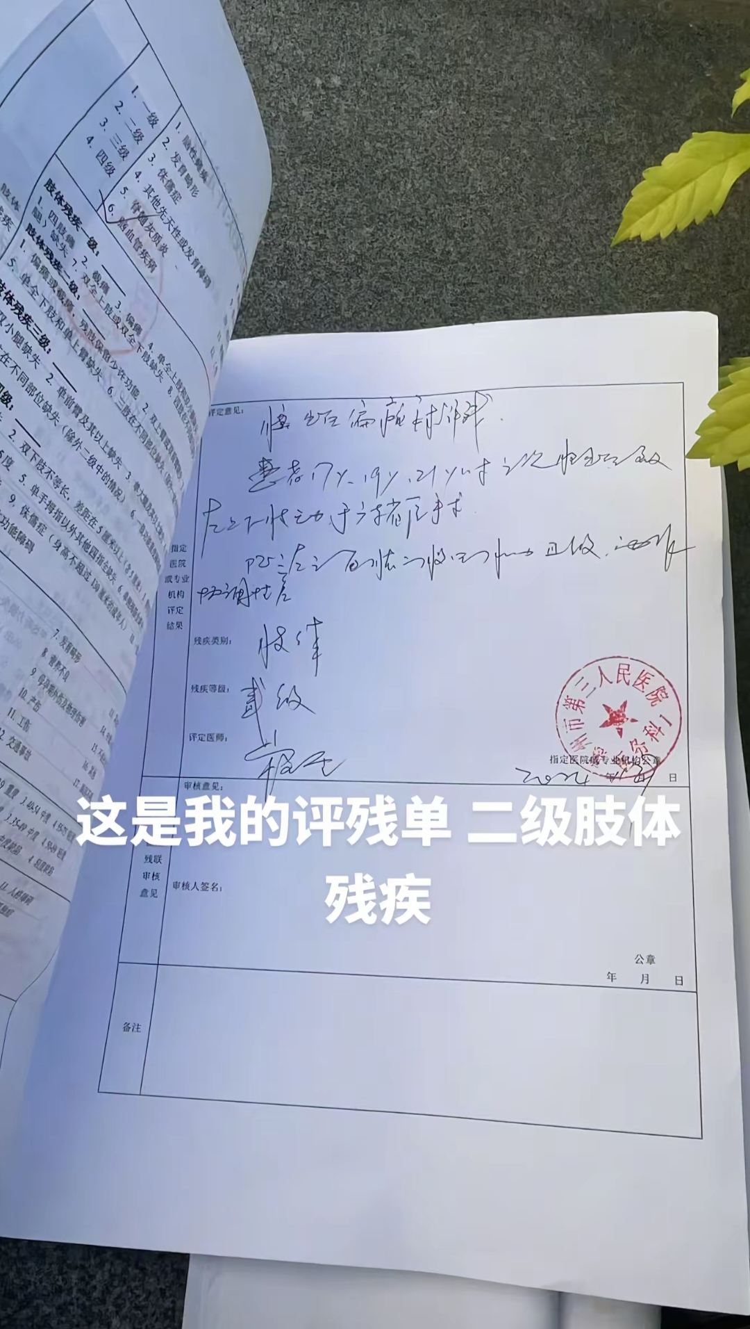 原因是动脉, 抢票一绝, amp